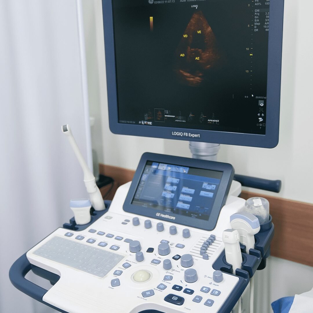 Equipamento moderno de ultrassonografia